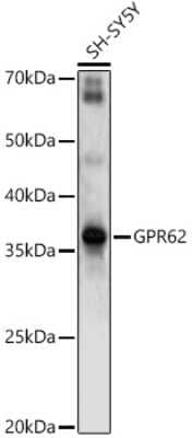 Western Blot: GPR62 Antibody [NBP3-03927] - Western blot analysis of extracts of SH-SY5Y cells, using GPR62 antibody (NBP3-03927) at 1:1000 dilution. Secondary antibody: HRP Goat Anti-Rabbit IgG (H+L) at 1:10000 dilution. Lysates/proteins: 25ug per lane. Blocking buffer: 3% nonfat dry milk in TBST. Detection: ECL Enhanced Kit. Exposure time: 90s.
